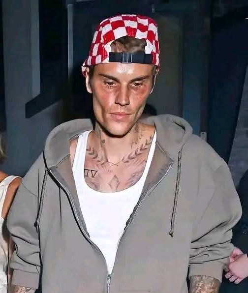 So sad checkout what happened to Justin Bieber…Read more